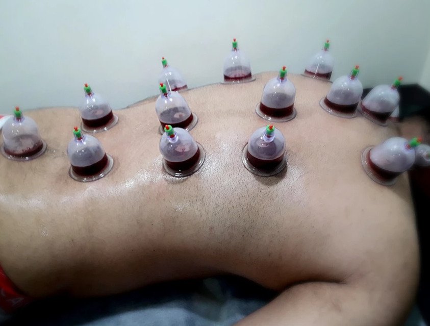 Ibnusina Ayurvedic Kalari Marma Chikilsalayam